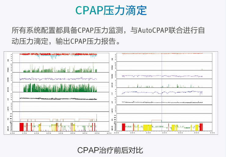 高流量呼吸濕化治療儀