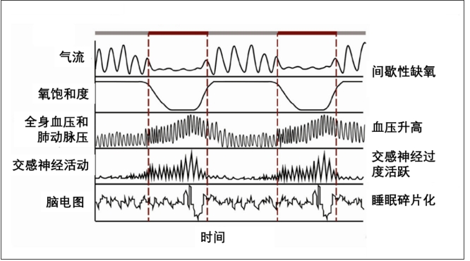 無創(chuàng)呼吸機(jī)